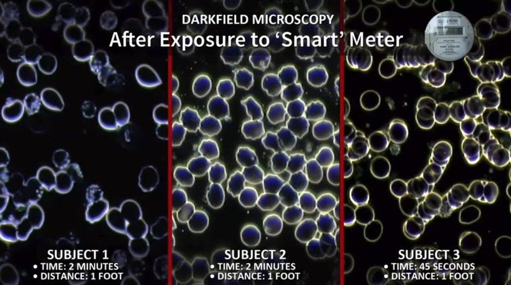 Cell Exposure from Smart Meters
