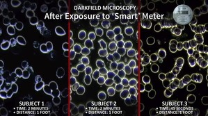 Cell Exposure from Smart Meters